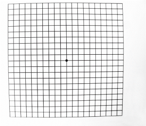 Amsler Grid as seen by a patient with a normal macula